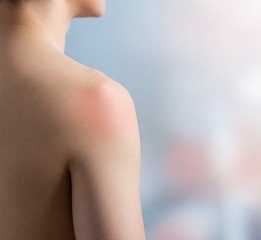 굽은 어깨(라운드 숄더) 교정, 이렇게 하면 좋아집니다!